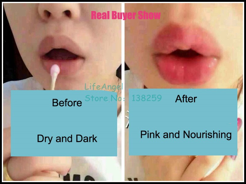 skin bleaching anus booty close up pussy