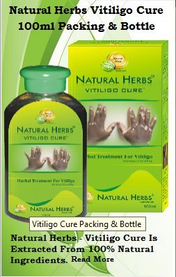 Best Vitiligo Treatment Usa