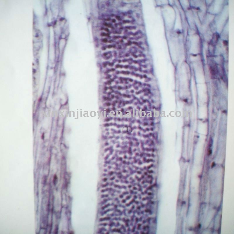 Moss Antheridial Head